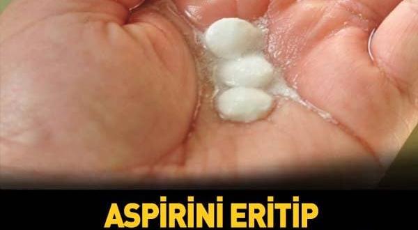 Aspirini Eritip Vücudunuzda Bacağınıza Sürerseniz Bakın Ne Oluyor!